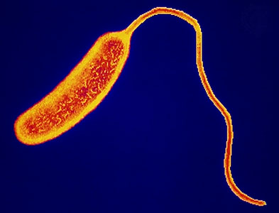 cholera-bacteria